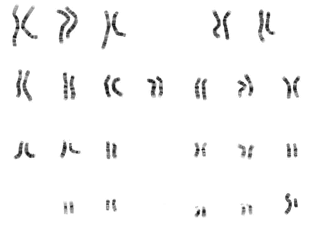 Image shows black and white pairs of chromosomes