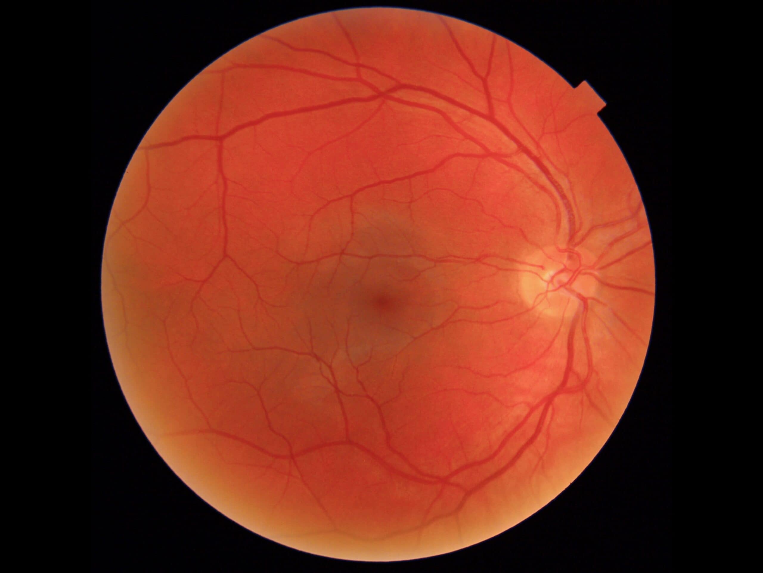 Retinal image