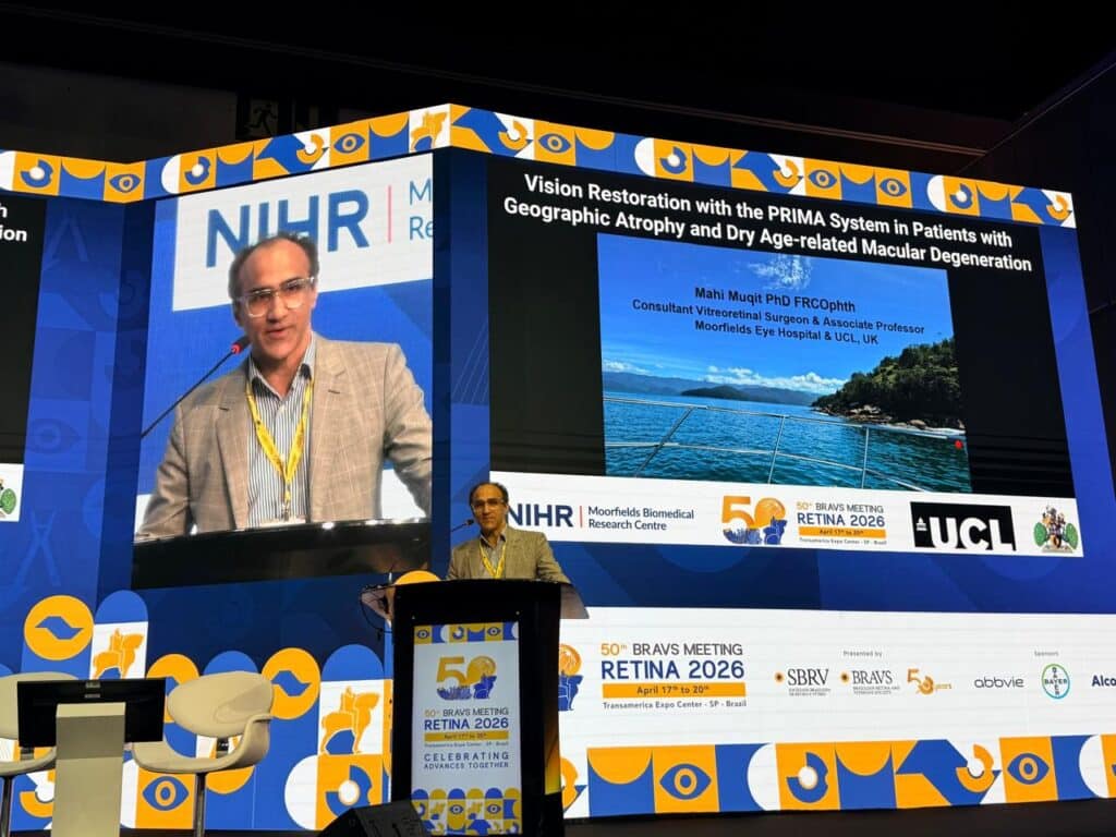 Image shows Dr Mahi Muqit a dark skinned man in a grey suit and blue shirt speaking at a podium on the stage of a large conference room at the Brazilan Retina and Vitreous Society 50th Anniversary Meeting, April 2026. The background is mainly blue and yellow and he is projected onto a large screen behind him. In addiditon there is a another screen showing a slide with the title of his presentation Vision Restoration with the PRIMA system in patients with Geographic atrophy and dry age-related macular degeneration. 