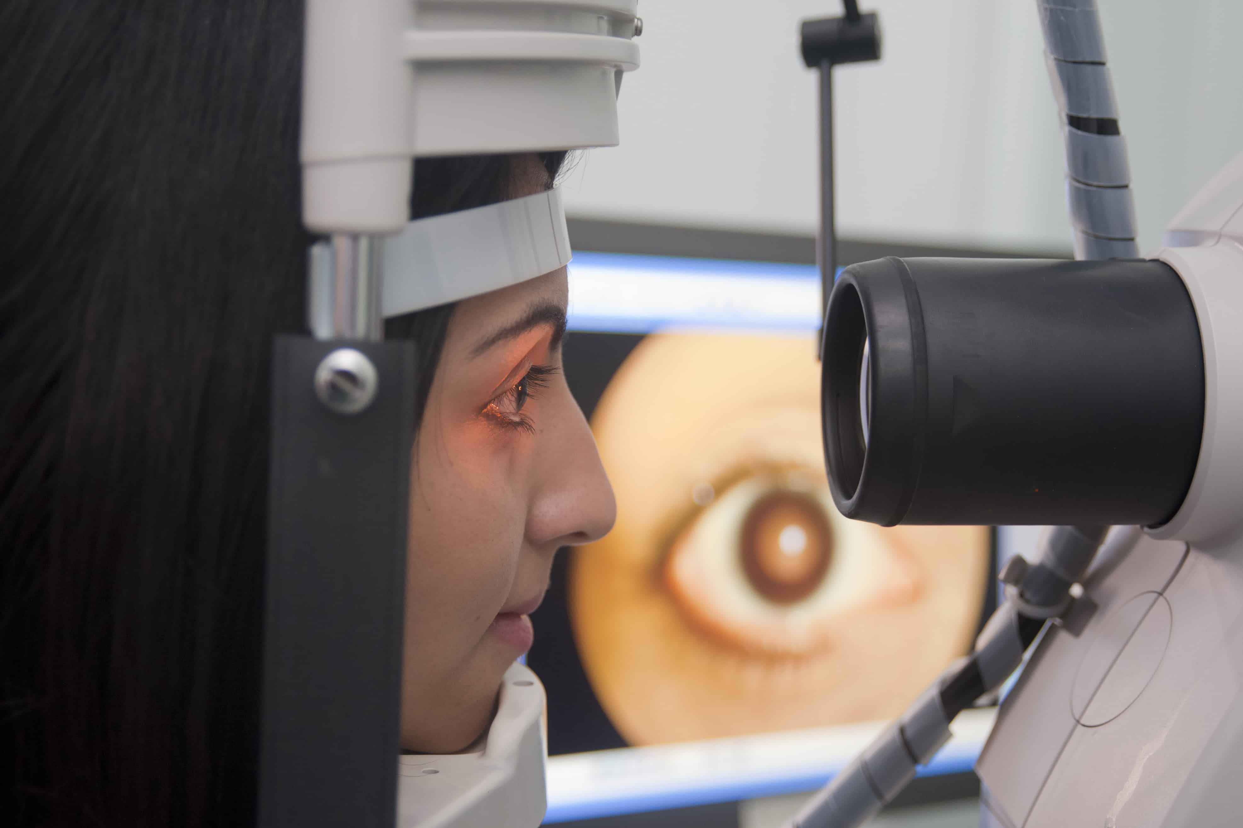 Close-up of a person undergoing an eye examination using a slit lamp microscope. A bright orange beam is illuminating the eye while optical equipment surrounds the face and head supports.